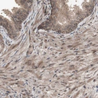 Immunohistochemical staining of human prostate shows moderate nuclear/cytoplasmic positivity in smooth muscle cells.