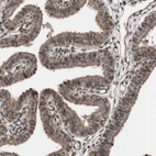 Immunohistochemical staining of human Fallopian tube shows moderate nuclear/cytoplasmic positivity in glandular cells.