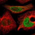 Immunofluorescent staining of human cell line A-431 shows localization to nucleoplasm.