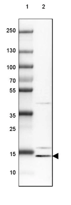 Lane 1: Marker [kDa] 250, 130, 100, 70, 55, 35, 25, 15, 10_br/_Lane 2: Human cell line RT-4