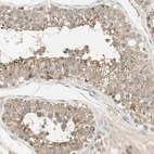 Immunohistochemical staining of human testis shows weak to moderate cytoplasmic positivity in cells in seminiferous ducts.