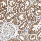 Immunohistochemical staining of human kidney shows moderate granular cytoplasmic positivity in cells in tubules.