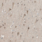 Immunohistochemical staining of human cerebral cortex shows weak cytoplasmic positivity in neurons.