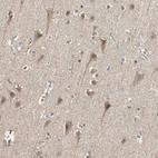Immunohistochemical staining of human cerebral cortex shows weak cytoplasmic positivity in neurons.