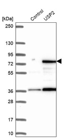 Western blot analysis in control (vector only transfected HEK293T lysate) and USP2 over-expression lysate (Co-expressed with a C-terminal myc-DDK tag (~3.1 kDa) in mammalian HEK293T cells, LY401351).