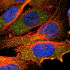 Immunofluorescent staining of human cell line U-251 MG shows localization to cytosol.