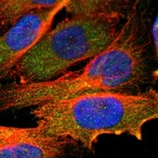 Immunofluorescent staining of human cell line U-251 MG shows localization to cytosol.
