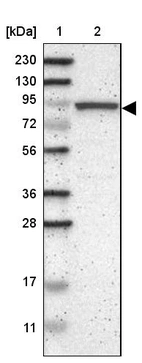 Lane 1: Marker [kDa] 230, 130, 95, 72, 56, 36, 28, 17, 11_br/_Lane 2: Human cell line RT-4