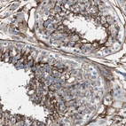 Immunohistochemical staining of human testis shows strong membranous positivity in cells in seminiferous ducts.
