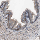 Immunohistochemical staining of human prostate shows moderate membranous positivity in glandular cells.