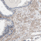 Immunohistochemical staining of human prostate shows weak to moderate membranous positivity in smooth muscle cells.