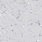 Immunohistochemical staining of human skeletal muscle shows no positivity in myocytes as expected.