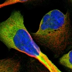 Immunofluorescent staining of human cell line U-2 OS shows localization to plasma membrane & cytosol.