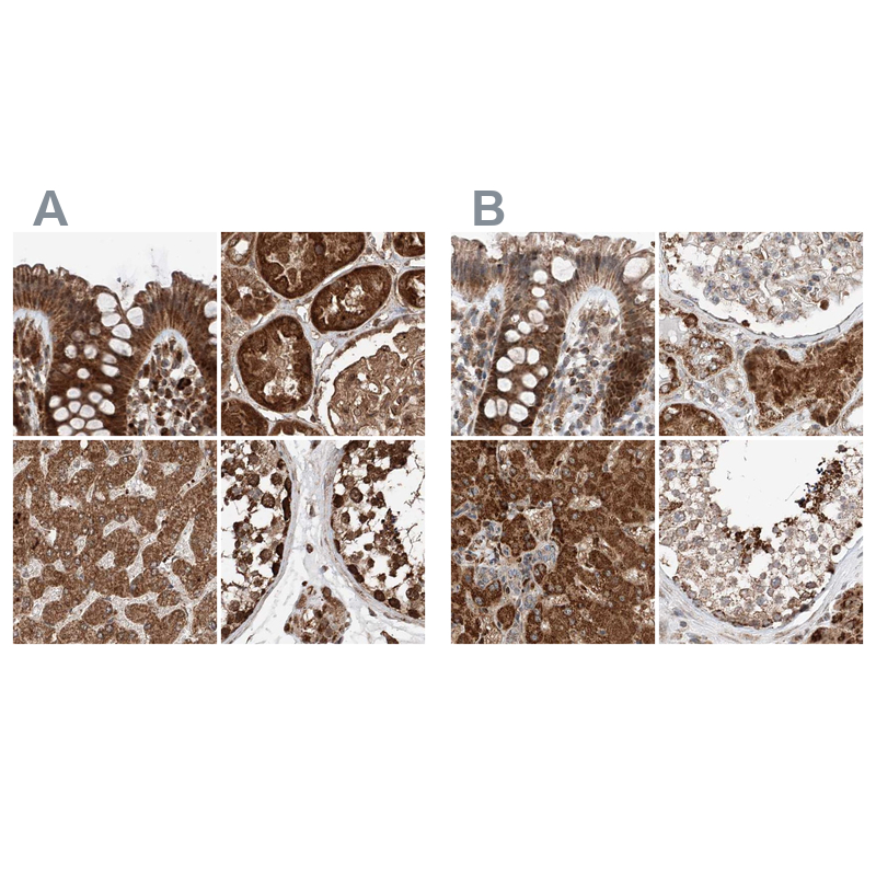 Anti-ZSCAN29 Antibody