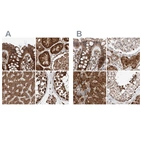 Anti-ZSCAN29 Antibody