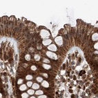 Immunohistochemical staining of human colon using Anti-ZSCAN29 antibody HPA007241.