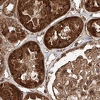 Immunohistochemical staining of human kidney using Anti-ZSCAN29 antibody HPA007241.