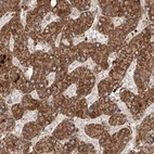 Immunohistochemical staining of human liver using Anti-ZSCAN29 antibody HPA007241.