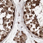 Immunohistochemical staining of human testis using Anti-ZSCAN29 antibody HPA007241.