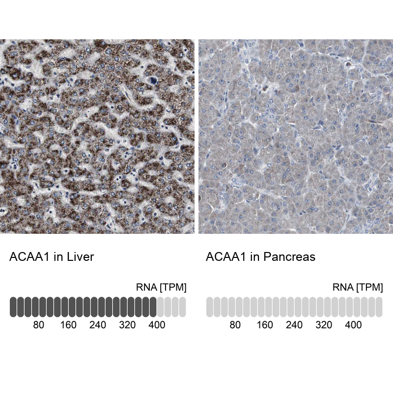 Anti-ACAA1 Antibody