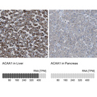 Anti-ACAA1 Antibody