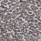 Immunohistochemical staining of human liver shows strong granular cytoplasmic positivity in hepatocytes.