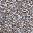 Immunohistochemical staining of human liver shows strong granular cytoplasmic positivity in hepatocytes.