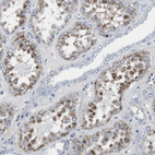 Immunohistochemical staining of human kidney shows strong granular cytoplasmic positivity in cells in proximal tubules.