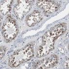 Immunohistochemical staining of human kidney shows strong granular cytoplasmic positivity in cells in proximal tubules.