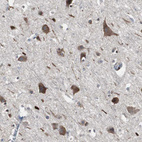Immunohistochemical staining of human cerebral cortex shows moderate granular cytoplasmic positivity in neuronal cells.
