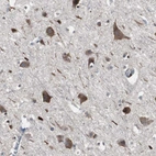 Immunohistochemical staining of human cerebral cortex shows moderate granular cytoplasmic positivity in neuronal cells.