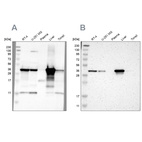 Western blot analysis using Anti-ACAA1 antibody HPA007244 (A) shows similar pattern to independent antibody HPA006764 (B).