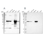 Western blot analysis using Anti-ACAA1 antibody HPA007244 (A) shows similar pattern to independent antibody HPA006764 (B).