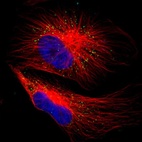 Immunofluorescent staining of human cell line U-251 MG shows localization to peroxisomes.