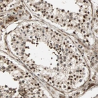 Anti-ZBED9 Antibody