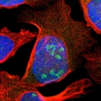 Immunofluorescent staining of human cell line U-2 OS shows positivity in nucleus & nucleoli.
