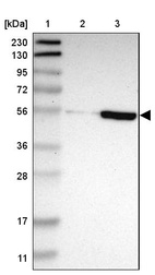 Anti-ZNF165 Antibody