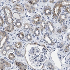 Anti-LAD1 Antibody