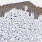 Immunohistochemical staining of human skin shows moderate cytoplasmic positivity in squamous epithelial cells.