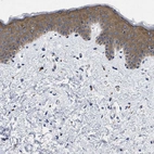 Immunohistochemical staining of human skin shows moderate cytoplasmic positivity in squamous epithelial cells.