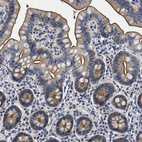 Immunohistochemical staining of human small intestine shows strong membranous positivity in glandular cells.