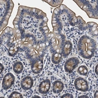 Immunohistochemical staining of human small intestine shows strong membranous positivity in glandular cells.