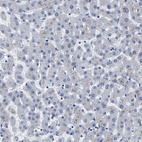 Immunohistochemical staining of human liver shows no positivity in hepatocytes as expected.