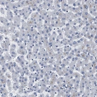 Immunohistochemical staining of human liver shows no positivity in hepatocytes as expected.