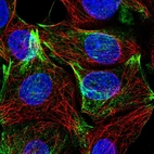 Immunofluorescent staining of human cell line MCF7 shows localization to actin filaments.