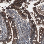 Immunohistochemical staining of human duodenum shows strong membranous positivity in glandular cells.
