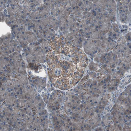 Rabbit Polyclonal Anti-SSTR2 Antibody - Buy for research