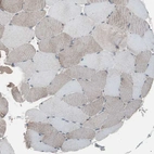Immunohistochemical staining of human skeletal muscle shows negative to very weak cytoplasmic positivity in myocytes.