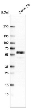 Western blot analysis in human cerebral cortex tissue.