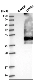 Western blot analysis in control (vector only transfected HEK293T lysate) and sSTR2 over-expression lysate (Co-expressed with a C-terminal myc-DDK tag (~3.1 kDa) in mammalian HEK293T cells, LY400438).